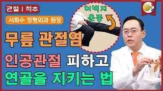 무릎 퇴행성관절염 인공관절을 피하는 연골 복원 치료법 제애정형외과병원 서희수 대표원장 [upl. by Assirod]