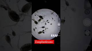 Identification of Zooplankton 😍 under Microscope🔬 plankton shorts aquaculture farming ytshorts [upl. by Kohcztiy585]