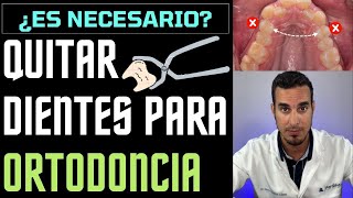 EXTRAER DIENTES para una ORTODONCIA  ¿Te han dicho de QUITAR los PREMOLARES ¿Es necesario [upl. by Quiteri809]