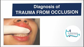 Diagnosis of TRAUMA FROM OCCLUSION TFOCLINICALRADIOGRAPHICFREMITUS TESTDR ANKITA KOTECHA [upl. by Franckot]