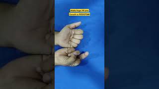 Middle finger PIP joint stiffness nerve physiotherapy joints movement anatomy ring ruhs nims [upl. by Hsinam230]