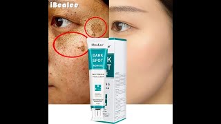 Whitening Freckle Cream Remove Melasma Dark Spot – iBeaLee™ [upl. by Leamaj]