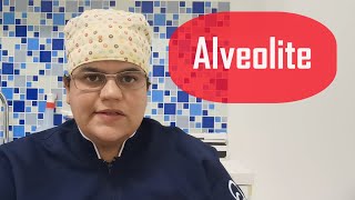 ALVEOLITE o que é Como EVITAR ComoTRATAR  Dra Bianca Rosa [upl. by Bowerman]