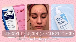 SALICYLIC ACID VS BENZOYL PEROXIDE FAVORITE DRUGSTORE PRODUCTS WHICH IS BETTER FOR YOUR SKIN [upl. by Dlared]