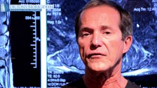 Facet vs Sacroiliac Pain with Spinal Pain Mapping by Dr Tony Mork [upl. by Zacks912]