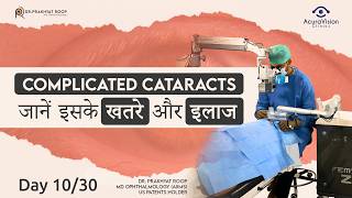 Complicated Cataracts जानें इसके खतरे और इलाज  Day 10  Dr Prakhyat Roop [upl. by Whittaker851]