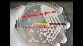 Cryptococcus neoformans Introduction morphology pathogenesis lab diagnosis and treatment [upl. by Jankey]