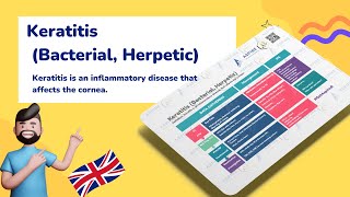 Keratitis Overview Bacterial amp Herpetic  Ophthalmology [upl. by Hazem906]