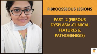 Fibrous Dysplasia Part 1  Fibroosseous Lesions Lecture Series  BDS MDS Online Video Lecture [upl. by Ydorb499]