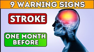 These 9 Warning Signs of Stroke One Month Before – Dont Ignore Them [upl. by Atinna]