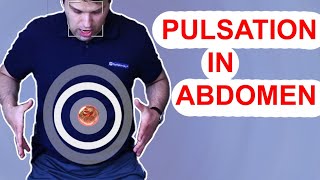 Pulsation in the Stomach Abdomen  Aortic Aneurysm USMLE 1 [upl. by Asirap]