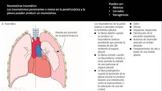 Enfermería  Adulto y Anciano  Trastornos pleurales [upl. by Anerual]