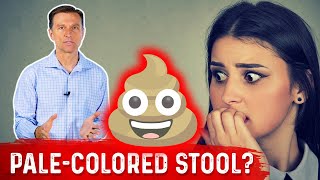 What Does PaleColored Poop Mean – DrBerg [upl. by Elyc]