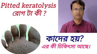 Pitted keratolysis রোগ টা কী  clinicalpatsala [upl. by Hsetih]