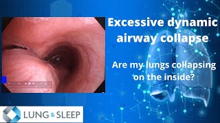 Excessive dynamic airway collapse  EDAC [upl. by Esilehc]