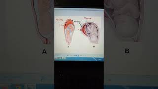 OSCE Obstetrics 8 [upl. by Arinayed403]