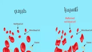 شرح مفصل عن الثلاسيميا  Explain detailed about thalassemia [upl. by Lemrej280]