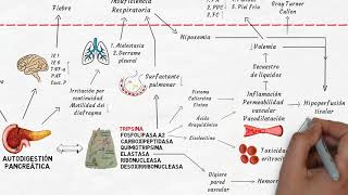 Fisiopatología de la pancreatitis aguda en 6 minutos [upl. by Salsbury]