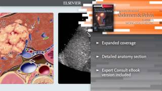 Diagnostic Ultrasound Abdomen and Pelvis [upl. by Reh]