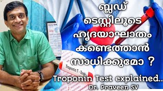 ബ്ലഡ്‌ ടെസ്റ്റിലൂടെ ഹൃദയാഘാതം എങ്ങനെ കണ്ടെത്താംTroponin test in malayalamTrop t testDrPraveenSV [upl. by Tenrag]