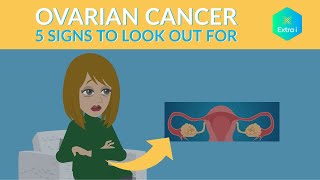 Signs of Ovarian Cancer Do You Know Them All [upl. by Eteragram]