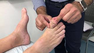 Lower Limb Neurological examination [upl. by Capp516]