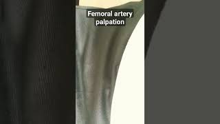 Femoral artery palpation logicmedico [upl. by Eelta13]