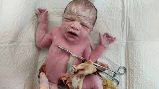 Cutest Newborn baby covered in Vernix just after birth viral baby cute [upl. by Aikemet807]