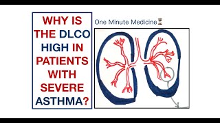 Why is the DLCO high in patients with severe Asthma  USMLE  One minute Medicine [upl. by Ranilopa]