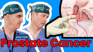 Prostate Cancer What You Need To Know [upl. by Litsyrk]