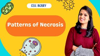 Cell injury and Necrosis part 2 patterns of necrosis [upl. by Ahsoik426]