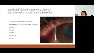 Your Primary Angle Closure Glaucoma A huge burden of Blindness Here Ophthalmology TeleCGR [upl. by Kelsy529]