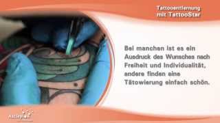 Tattooentfernung mit dem QSwitchLaser TattooStar von Asclepion [upl. by Bellanca]