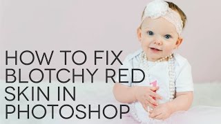 How to Fix Blotchy Red Skin in Photoshop [upl. by Colp]