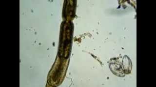 Turbellaria microscopic flatworm eating [upl. by Falcone]