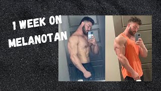 1 week on melanotan  Side effects [upl. by Reginald]