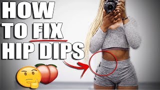 HOW TO FIX HIP DIPS  10 SIMPLE EXERCISES [upl. by Ros923]