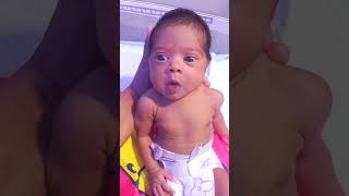 New born baby eyes expressionnewbornbaby ytshorts trendingshorts medicalstudent shorts [upl. by Ahset]