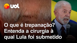 Lula faz cirurgia na cabeça presidente passa por trepanação para drenagem de hemorragia entenda [upl. by Julie]