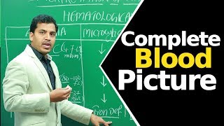 Complete Blood Picture  Hematological Test  Lab Parameters [upl. by Mcferren]