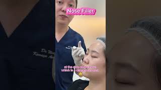 Where and How Fillers are Injected [upl. by Boccaj175]