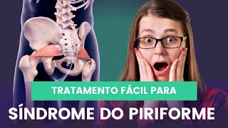 Sindrome do Piriforme fisioterapiaintegrativa fisioterapia colunasemdor sindromedopiriforme [upl. by Armalla753]