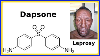 dapsone [upl. by Fairleigh]