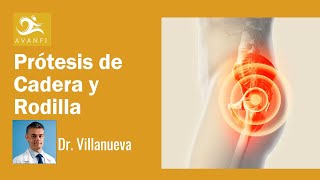 Prótesis de Cadera y Rodilla por el Especialista en Casos Complejos Dr Villanueva [upl. by Otila265]