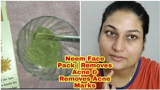 DIY Neem powder Face Pack  Removes Acne amp Removes Acne Marks  For All Skin Types [upl. by Schmitt]