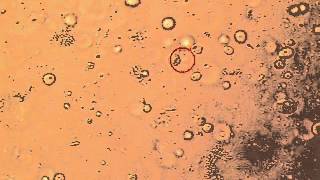 Abnormal Semen Analysis [upl. by Nairim]