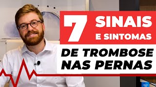 7 SINAIS E SINTOMAS DE TROMBOSE NAS PERNAS [upl. by Di214]