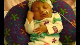 Lylas Gastroschisis Journey [upl. by Alic402]