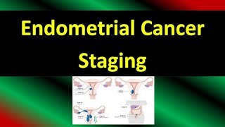 Endometrial Cancer Staging FIGO Guideline 2023 Updates [upl. by Sekyere]