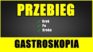 GASTROSKOPIA  Jak przebiega Krok po Kroku [upl. by Leahcam]